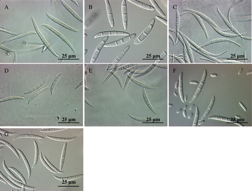 Figure 1.  Macroconidia of Fusarium species from soil in the North China Plain as produced on carnation leaf-piece agar (CLA). A: F. proliferatum; B: F. solani; C: F. equiseti; D: F. semitectum; E: F. polyphialidicum; F: F. oxysporum; and G: F. merismoides (magnification×400; bar = 25 µm).