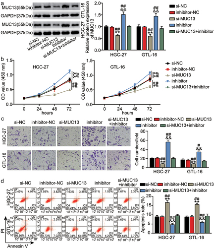 Figure 6. MiR-361-3p knockdown promoted GC progression by targeting MUC13. (a) The expression level of miR-361-3p was evaluated in groups of si-NC, inhibitor-NC, inhibitor, si-MUC13, and si-MUC13+ inhibitor by qRT-PCR. (b-d) The cell proliferation (b), invasion (c), and apoptosis (d) were measured in groups of si-NC, inhibitor-NC, inhibitor, si-MUC13, and si-MUC13+ inhibitor using CCK-8, Transwell and flow cytometry assays, respectively. **P < 0.001 vs si-NC, &&P < 0.001 vs inhibitor-NC. ##P < 0.001 vs si-lnc+inhibitor.