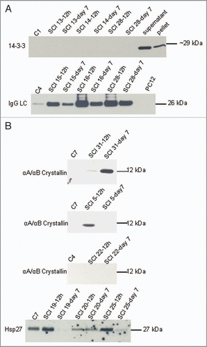 Figure 2 14-3-3 and IgG light chain levels in CS F after spinal cord injury. (A) Western analysis of 14-3-3 and IgG light chain after spinal cord injury. Three patients are shown. 14-3-3 is absent in all CS F samples. IgG light chains are present in varying amounts in all samples. 20 µg of rat brain supernatant and pellet fractions and 20 µg of PC12 cell homogenate (middle) are shown in the right lanes. (B) Western analysis of CS F (40 µl) after spinal cord injury for αA/αB crystallin and Hsp27.