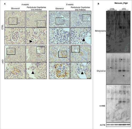 Figure 4. Accumulation of ROS in the glomeruli of atg5-cKO mice. (A) Representative images of the immunohistochemical analysis for dityrosine in kidney sections from 4- or 8-wk-old Atg5-CTRL (upper) and atg5-cKO (lower) mice. Small arteries are indicated with arrowheads. The lower panels show a magnification of the indicated areas (black squares) in the upper panels. Bars: 20 μm. (B) Western blot analysis for dityrosine, nitrotyrosine, and 4-HNE using isolated glomeruli homogenates from 8-wk-old atg5-cKO mice and their Atg5-CTRL littermates (n = 3 in each group).