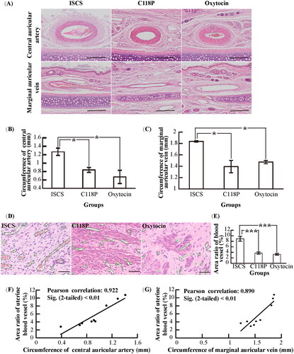 Figure 3. Vascular changes in rabbit ears and uterus in the ISCS, C118P and oxytocin groups. (A) Microscopic imaging of HE staining for central auricular arteries and marginal auricular veins. Bar: 250 μm. (B, C) Statistical analysis of the circumferences for central auricular arteries (B) and marginal auricular veins (C). Data were significantly different: *p< .05 (n = 3 per group). (D) Microscopic imaging of HE staining for uterine blood vessels. The green line shows the blood vessel outline. Bar: 50 μm. (E) Statistical analysis of the area ratio for uterine blood vessels. Data were significantly different: ***p< .001 (n = 4 per group). (F) Correlation analysis between central auricular arteries and uterine blood vessels. (G) Correlation analysis between marginal auricular veins and uterine blood vessels.