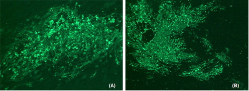 Figure 1. Photographs of HVT-ND-IBD plaques stained with antibodies specific to the two inserted gene products. (A) HVT-ND-IBD plaque stained with anti-NDV F monoclonal antibody, 57NDV, followed by a FITC-labelled goat anti-mouse IgG. (B) HVT-ND-IBD plaque stained with anti-IBD VP2 monoclonal antibody, R63, followed by a FITC-labelled goat anti-mouse IgG.