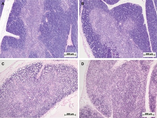 Figure 4 Morphological changes in the thymus of female and male Wistar rats on the first day after LPS injection of one of two doses: 1.5 or 15 mg/kg.Notes: Hematoxylin and eosin staining. Original magnification: 100×. (A) Female, 1.5 mg/kg LPS – hyperplasia of the thymus, a broad cortex densely populated with lymphocytes, distinct boundaries between the cortex and medulla. (B) Male, 1.5 mg/kg LPS – mild atrophy of the thymus. (C) Female, 15 mg/kg LPS – severe atrophy of the thymus, destruction of the cortex. (D) Male, 15 mg/kg LPS – severe atrophy of the thymus, more pronounced compared with that of females (C), inversion of cortex and medulla, indistinct boundaries between the cortex and medulla.Abbreviation: LPS, lipopolysaccharide.