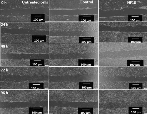Figure 6. Wound scratch images for untreated cells, control, and NF10 for 0, 24, 48, 76, and 92 h.