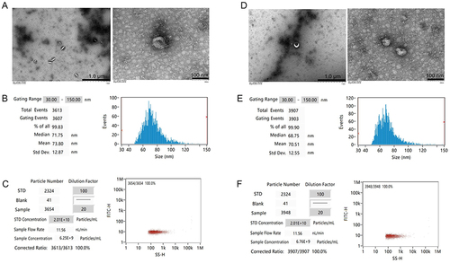 Figure 2 Identification and comparison of exosomes. The morphology (A and D), diameters distribution (B and E), and concentration (C and F) of the CFs-Exo and Sev-CFs-Exo were observed by the transmission electron microscope and nanoparticle tracking analysis (The former is CFs-Exo).