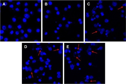 Figure 9 Fluorescence microscope images of (A) control, (B) DNR, (C) DNR+GA, (D) DNR-Cys-CdTe, and (E) DNR-GA-Cys-CdTe NPs. (400×).Note: The typical phenomena of apoptosis were indicated by red arrows.Abbreviations: Cys, cysteamine; CdTe, cadmium-tellurium; DNR, daunorubicin; GA, gambogic acid; NPs, nanoparticles.