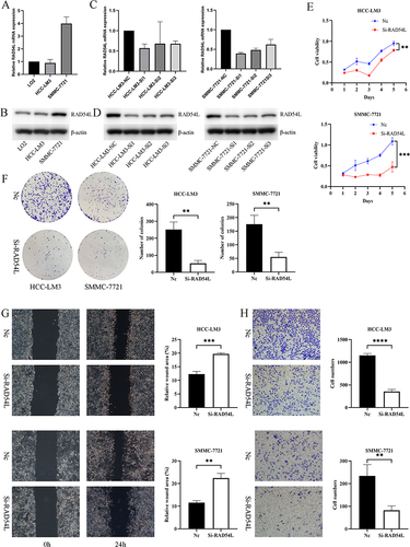 Figure 9 In vitro experiments of RAD54L in HCC cells. (A) Expression levels of RAD54L in LO2, HCC-LM3, and SMMC-7721. (C) Knocking down of RAD54L in two HCC cells. Western blotting detection of RAD54L protein expression levels in LO2, HCC-LM3 and SMMC-7721 cell lines (B). Western blotting showed alterations in HCC-LM3 and SMMC-7721 cells after RAD54L knockdown (D). CCK-8 assay (E) and Colony-forming assay (F) showing inhibition of cell proliferation after knockdown of RAD54L. Wound-healing assay (G) and Transwell assay (H) showing that knockdown of RAD54L reduces the migratory capacity of HCC cells.