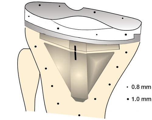 Figure 1. Distribution of the 0.8-mm and 1.0-mm tantalum markers in the polyethylene component of the prosthesis.