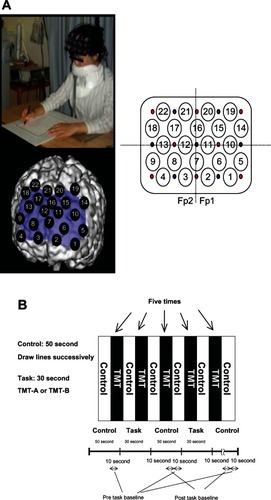 Figure 1 Study design. (A) Location of channels; (B) protocol.