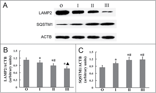 Figure 3. Delivery of autophagosomes to lysosomes was blocked in AMs of silicosis patients. (A) The expression of LAMP2 and SQSTM1 proteins was analyzed by western blot. ACTB was used as a loading control. (B and C) LAMP2/ACTB and SQSTM1/ACTB ratios of each patient group. n = 11 for the observer group, n = 14 for stage I, II and III groups. *, P < 0.05 vs. observer group，#, P < 0.05 vs. stage I patient group, ▴, P < 0.05 vs. stage II patient group. O, observer group; I, stage I patient group; II, stage II patients group, III; stage III patient group.