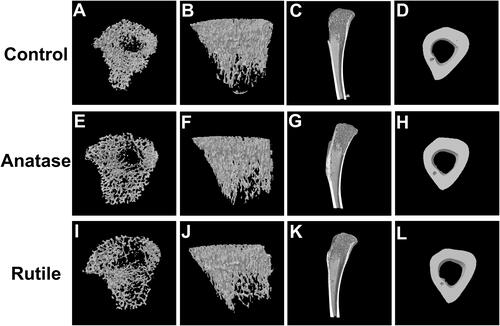 Figure 5 Three-dimensional images of tibia. (A) Cross-sectional image of trabecular bone in the control group. (B) Overall image of trabecular bone in the control group. (C) Sagittal image of bone in the control group. (D) Cross-sectional image of cortical bone in the control group. (E) Cross-sectional image of trabecular bone in the anatase TiO2 NP group. (F) Overall image of trabecular bone in the anatase TiO2 NP group. (G) Sagittal image of bone in the anatase TiO2 NP group. (H) Cross-sectional image of cortical bone in the anatase TiO2 NP group. (I) Cross-sectional image of trabecular bone in the rutile TiO2 NP group. (J) Overall image of trabecular bone in the rutile TiO2 NP group. (K) Sagittal image of bone in the rutile TiO2 NP group. (L) Cross-sectional image of cortical bone in the rutile TiO2 NP group.