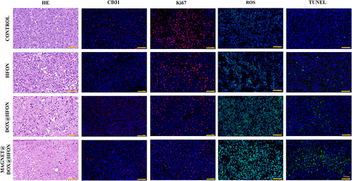 Figure 8 H&E, CD31, Ki-67, ROS immunofluorescence staining and TUNEL apoptosis detection pictures of tumor sections in each group (the scale bar is 100μm).