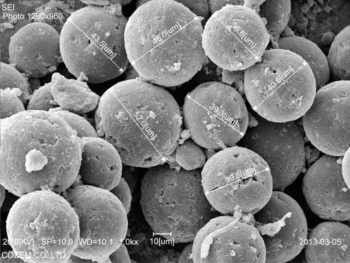 Figure 17 SEM demonstrating CaHA filler particle size as 36–52 microns at 1000× magnification. Particles had smooth surfaces, were completely spherical, and had about 3-micron-sized small holes in the surface.