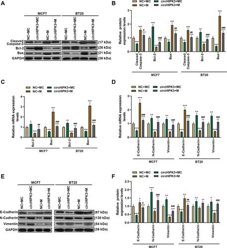 Figure 6 Overexpression of miR-326 partially reversed the effect of circHIPK3 on apoptosis and epithelial–mesenchymal transition-related genes. (A–C) The expressions of apoptosis-related genes (cleaved Caspase-3, Bcl-2 and Bax) in NC + MC, circHIPK3+ MC, NC + M, and circHIPK3 +M groups were detected by Western blot and RT-qPCR. (D–F) The expressions of E-Cadherin, N-Cadherin and vimentin in NC + MC, circHIPK3+ MC, NC + M, and circHIPK3 +M groups were detected by Western blot and RT-qPCR. Each experiment was repeated three times independently. GAPDH was set as control. *P < 0.05, **P < 0.01, ***P < 0.001 vs NC + MC; ^P < 0.05, ^^P < 0.01, ^^^P < 0.001 vs circHIPK3 + MC; #P < 0.05, ##P < 0.01, ###P < 0.001 vs NC + M.