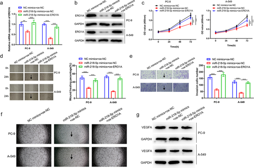 Figure 4. MiR-218-5p represses LUAD cell progression, and angiogenesis through targeting ERO1A. (a) ERO1A mRNA level in NC mimics+oe-NC, miR-218-5p mimics+oe-NC and miR-218-5p mimics+oe-ERO1A groups. (b) ERO1A protein expression level in each treatment group. (c) Changes in proliferation of LUAD cells. (d) Changes in migration of LUAD cells (40×). (e) Changes in invasion of LUAD cells (100×). (f) Angiogenesis status in the differently treated groups. (g) VEGFA protein expression level in the differently treated groups. **P < 0.01 vsPvs