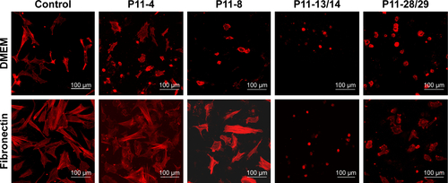 Figure S3 Fibronectin coating of P11-SAP hydrogels.Notes: Fluorescent depiction of the actin cytoskeleton of HCO cultured for 24 hours on P11-SAP hydrogels under noncoated/serum-free condition or precoated with fibronectin (confocal microscopy, fibronectin concentration 300 μg/mL, scale bar 100 μm).Abbreviations: HCO, human calvarial osteoblasts; P11-SAP, 11-amino acid self-assembling peptide.