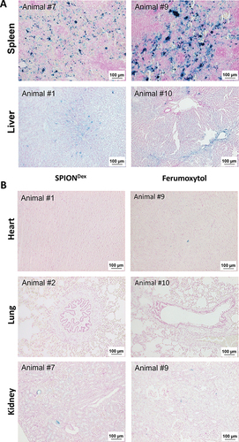 Figure 5 Accumulation of SPIONs at 26 h post-administration detected in the organs using Prussian blue staining. (A) Spleen and liver are the main accumulation sites of SPIONs; (B) none or only very weak iron signal is detectable by histology in heart, lungs or kidneys of SPION-treated rabbits. Images in the left panel show SPIONDex-treated animals, images in the right panel images, ferumoxytol-treated animals.