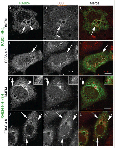 Figure 6. Prenylation-competent mutants of RAB24 are targeted to LC3 vesicles. Mutant RAB24 plasmids were expressed in NRK cells. Cells were kept in full-culture medium (DMEM) or treated with serum and amino acid-free medium (EBSS) for 4 h and after fixation labeled with antibodies against RAB24 and LC3. Prenylated mutants, HHΔ (A to F) and HHSN (G to L), resembled wild-type RAB24 with a perinuclear localization (arrowheads, compare with Fig. 4A). Further, both mutants partially colocalized with LC3 both in full culture-medium and after a 4 h EBSS treatment (arrows). Inserts highlight the colocalization in panels G to I. For quantitative analysis of colocalization, see Figure S3. Bar: 10 μm.