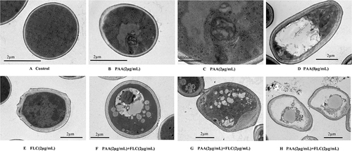 Figure 4 The intracellular ultrastructure of C. tropicalis cells after treatment by PAA and FLC. The C. tropicalis cells were incubated without (A - control) or with agents ((B and C) −2µg/mLPAA, (D) −8µg/mLPAA, (E) −2µg/mLFLC, (F–H) −2µg/mLPAA+2µg/mLFLC). After incubation for 24h, using the method of Transmission electron microscopy to observe the intracellular ultrastructure of C. tropicalis cells.