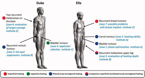 Figure 1. Overview of the different clinical example cases, as discussed in this paper to illustrate clinical decision making facilitated by HTP. A treatment strategy should be formulated for the specific equipment available at the institute concerned. Patient models used in these examples were based on the virtual family models Duke and Ella [Citation54].