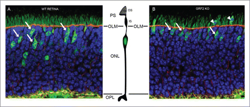 Figure 1. Abnormal presence of “ectopic” cone photoreceptor nuclei in the Photoreceptor Segments (PS) area of adult, GRF2-KO mouse retinas. (A) During the late migratory phase of development of wild-type retinas, the nuclei of cone photoreceptors migrate toward the outer limiting membrane (OLM) and are finally located in areas proximal to that physiological barrier (tailed arrows) within the scleral part of the retina (ONL). (B) In GRF2-KO retinas, the nuclei of cone cells end up located at positions much closer to the OLM (tailed arrows) and in some cases even trespass this limiting membrane (“ectopic” nucleus) and protrude into the photoreceptor segments (PS) area (arrowheads). In these pictures, the cone cells were labeled in green with anti-NSE (neuron specific enolase) antibodies, the OLM was labeled in red with β-catenin, and the nuclei were labeled with Hoechst. OS, outer segments; IS, inner segments; ONL, outer nuclear layer; OPL, outer plexiform layer. Scale bar: 25µm.