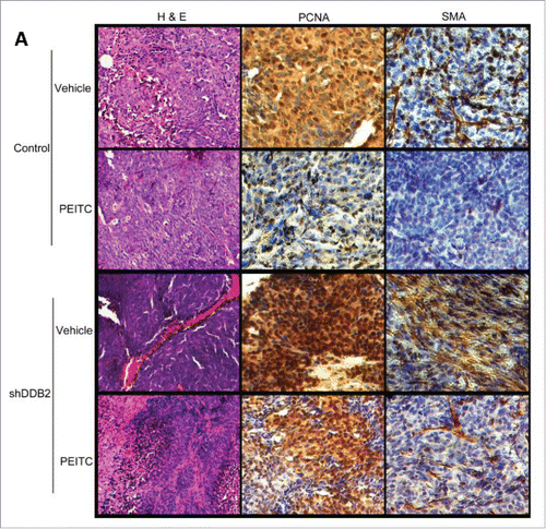 Figure 5. DDB2 deficiency abrogates PE ITC-mediated regression in tumor aggressiveness. HCT116 cells expressing control shRNA or DDB2 shRNA were injected subcutaneously into nude mice. Mice were divided randomly in two groups for each cell line for treatment with PE ITC or vehicle control. Four weeks post treatment mice were sacrificed and tumor sections were fixed in 10% Formalin, processed and embedded with paraffin for sectioning. Prepared tumor section slides were then subjected to immunohistochemical analysis using H&E, PCNA or SMA antibody (A). Representative images (20 × magnification) are shown.