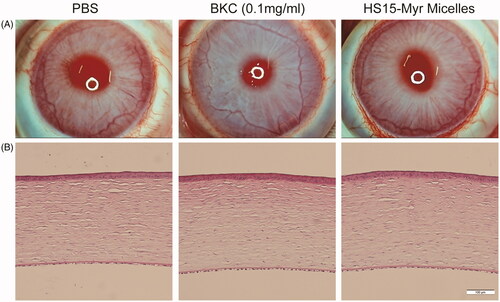 Figure 4. Ocular tolerance observation of HS15-Myr micelle ophthalmic solution. (A) Representative slit-lamp biomicroscopic images, and (B) representative histopathologic images of rabbit corneas 24 h after topical installations. PBS, 0.1 mg/ml benzalkonium chloride (BKC) in PBS solution, and the HS15-Myr micelle ophthalmic solution with a weight ratio of HS15 and Myr (21:1 wt%) were tested in this experiment. Each formulation was instilled in the right eye 13 times for 30 min, and the left eyes were left untouched as a control. Clinical signs were evaluated before the test and at 1, 6, and 24 h after the last installation. At 24 h after the last installation, two rabbits chosen randomly from each group were euthanized, and the corneas were excised. After fixation in 10% formaldehyde solution for at least 24 h and dehydration with an alcohol gradient, the corneas were prepared for hematoxylin-eosin (HE) using routine methods and analyzed with light microscopy. All samples were treated simultaneously to reduce variations related to the fixation procedure (Bar = 100 μm).