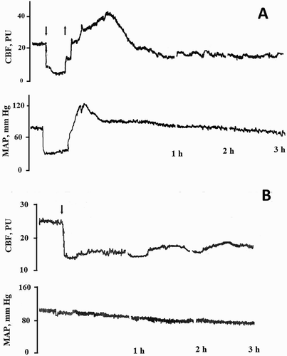 Figure 1. Example of experimental curves of cerebral blood flow (CBF) and mean arterial pressure (MAP) at global (A) and focal (B) cerebral ischaemia in rats. Arrow down – the beginning of ischaemia, arrow up – the end of ischaemia.