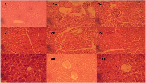 Figure 5. Microscopic examination of tissue histology of vital organ (liver, kidney and heart) to examine any necrosis or histological change as compare to control for these organs after treatment with formulations: (a) heart tissue of control; (1a) treated with MTC, (2a) treated with MTC-control; (b) kidney tissue of control, (1b) treated with MTC, (2b) treated with MTC-blank; (c) liver tissue of control, (1c) treated with MTC and (2c) treated with MTC-blank.