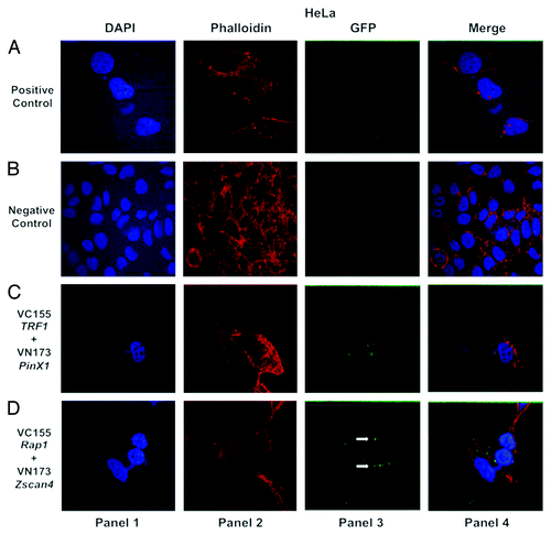 Figure 4. Confocal images of bimolecular fluorescence complementation (BiFC) results in HeLa cancer cells. The BiFC performed in HeLa cancer cells reflects the same patterns observed for MCF7 cells (Fig. 2) and SaOS2 cells (Fig. 3). The interaction between Zscan4 and Rap1 (shown in panel 3 of [D]) demonstrates the same relationship in HeLa cancer cells. Cells were visualized using the same conditions as described in Figure 2.