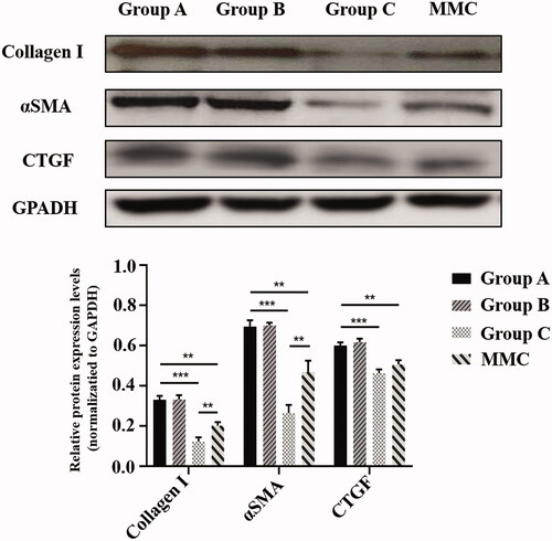Figure 6. Rabbit bleb tissues in five groups were harvested at POD 28. Protein levels of Collagen 1, αSMA, and CTGF were determined by immunoblot. GAPDH was used as loading control. Immunoblots were scanned and the band intensity of each specific protein was normalized to that of corresponding GAPDH. Results are mean ± SEM (n = 3 per group). **p < .01 and ***p < .001.
