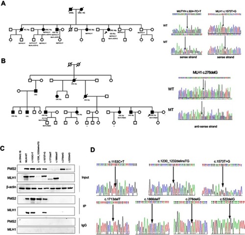 Figure 3 Evidence to identify germline variants for pathogenicity. (A) Pedigree of family W. (B) Pedigree of family T. (C) Western-blot analysis of MLH1 and PMS2 proteins. (D) Characterization of constructed MLH1 mutated plasmids. Numbers represent age at diagnosis. Minus signs indicate that the individual was confirmed not to carry the specific mutation. Shading indicates that the individual was affected with cancer. The arrow heads indicate the proband for that family.Abbreviations: CRC, colorectal cancer; CHOL, cholangiocarcinoma; HC, hepatic cancer; BC, breast cancer; PC, pancreatic carcinoma; OC, ovarian cancer; GC, gastric cancer.