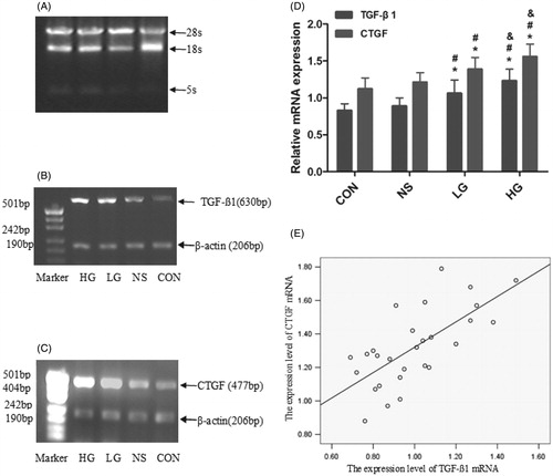 Figure 6. Analysis of the TGF-β1mRNA, CTGF mRNA expression in peritoneal tissue by RT-PCR. (A--C) The image of mRNA by RT-PCR. (D) The semi-quantitative results of TGF-β1, CTGF mRNA expression. (E) The liner correlation analysis of expression level of TGF-β1 mRNA and CTGF mRNA, the Correlation coefficients was 0.78 (r = 0.69, p = 0.000). Data presented as mean ± SD.*Denotes p < 0.05 versus the control group. #Denotes p < 0.05 versus the NS group. &Denotes p < 0.05 versus the LG group.