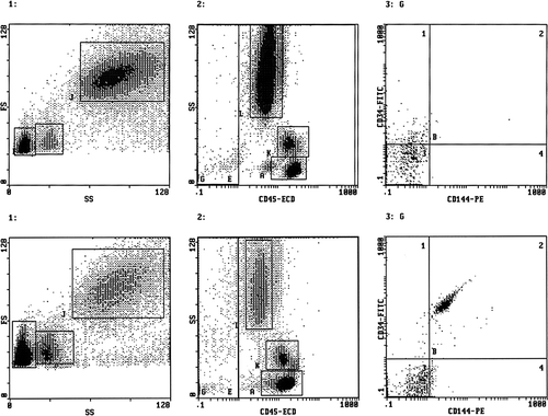 Figure 1. Representative fluocytometric scattergrams showing the gating strategy used in a normal healthy men (upper panels) and in a patient with late onset hypogonadism and erectile dysfunction (lower panels). Both histograms 1 report the forward versus side scatter dot plot: three different cell populations can be identified (gate F: lymphocytes; gate I: monocytes; gate J: polymorphonuclear cells). Both histograms 2 report the CD45pos (E) and CD45neg (G) cells. Both histograms 3 report only the CD45neg cells (gate G) subdivided according to the expression of CD34 and CD144 antigen staining. EPCs were defined as CD45neg/CD34pos/CD144pos, whereas EMP CD45neg/CD34neg/CD144pos.