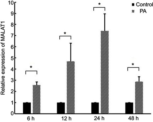 Figure 1 Expression of MALAT1 in cardiomyocytes after treatment with palmitic acid (PA). *P<0.05. Data are presented as means ± standard error from three independent experiments.