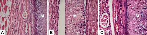 Figure 5 Hematoxylin/eosin-stained sections of subcutaneously-implanted nHA/PA66 membrane and surrounding tissue, which were harvested at 1 (A), 4 (B), and 8 (C) weeks post-implantation (magnification:400×). In the photos, M denotes the nHA/PA66 membrane.