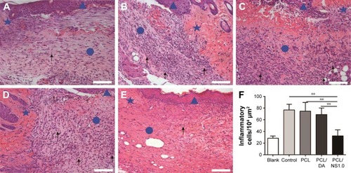 Figure 12 The inflammatory cells infiltrated in the subcutaneous areas of wound edge at day 7 post surgery.Notes: Representative H&E staining images of the (A) blank, (B) control, (C) PCL, (D) PCL/DA and (E) PCL/NS1.0 groups. The triangle represents the newly formed epidermis, the circle represents the wound area, and the pentagram represents unwounded skin tissue. The black arrows indicate the inflammatory cells. (F) Counting of inflammatory cells infiltrated in the subcutaneous areas of wound edge. Data are presented as mean ± SD (n=4). Scale bars: 100 µm. Magnification ×200. **p<0.01.Abbreviations: DA, dopamine; H&E, hematoxylin–eosin; NS, nanosilver; PCL, polycaprolactone.