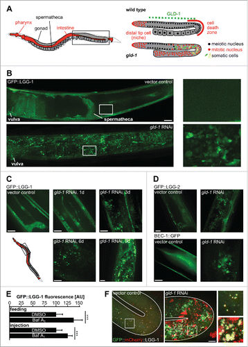 Figure 1. Autophagy-related proteins are expressed in a subset of cells within germline tumors. (A) The C. elegans gonad as a model for tumorigenesis. Anatomy of an adult hermaphrodite. One gonad arm (boxed area) is shown enlarged on the right for wild-type and gld-1 (mutant or RNAi) animal. GLD-1/quaking expression region is indicated by the green dashed line. (B) GFP::LGG-1 expression in the gonad of wild-type and gld-1 RNAi-treated animals. Left panels: Representative gonad arms reconstructed from maximum projections of gonad z-planes. Boxed areas are shown enlarged on the right. The region reconstructed is depicted in the boxed area of the scheme in panel A. (C) GFP::LGG-1 expression in the gonad of a gld-1 RNAi-treated animal from d 1 to d 9 of adulthood. Maximum projections of gonad z-planes. Boxed area in the scheme represents the region depicted in the z-projections of panels (C, D, and F) GFP::LGG-2 and BEC-1::GFP expression in the gonad of wild-type and gld-1 knockdown animals at d 3 of adulthood. Maximum projections of gonad z-planes. Scale bars: 20 μm. (E) Quantification of GFP::LGG-1 fluorescence intensity in gld-1 tumors in DMSO (control) and Baf-treated animals (n = 10 each), ***, P ≤ 0.001. (F) Representative maximum projections of GFP::mCherry::LGG-1 expressing animals. A control animal's gonad turn region (left) and a gld-1 RNAi-treated animal's germline tumor turn region (right) are shown. Boxed areas are shown enlarged on the right. Scale bar: 10 μm