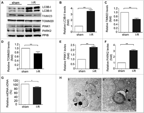 Figure 4. Mitophagy is induced in proximal tubular cells after renal ischemia-reperfusion in mice. C57BL/6 wild-type mice (male, 8–10-wk old) were subjected to 30 min of bilateral renal ischemia followed by 48 h of reperfusion (I-R) or sham operation (Sham). Renal cortex and outer medullawere collected for immunoblot analyses of LC3B-I/II, TIMM23, TOMM20, PINK1, PARK2 and PPIB (loading control), for mitochondrial DNA content analysis, and for transmission electronic microscopyanalysis. (A) Representative blots. (B-E) Densitometry of LC3B-II (B), TIMM23 (C), TOMM20 (D), PINK1 (E) and PARK2 (F) signals. The signal of each protein of the I-R samples was divided by that of the sham control that was arbitrarily set as 1. (G) Relative mitochondrial DNA content (mtDNA:nDNA). (H) Representative TEM images of autophagosomes (pointed to by the arrowhead in the left panel) and a mitophagosome (pointed to by the arrowhead in the right panel) in renal proximal tubule cells after I/R. Error bars: SEM, n = 3. *p<0.05; **p<0.01; ***p<0.001; ns, not significant.