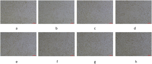 Figure 3. The photos taken during cell culture were taken before each cell bottle division. The pictures taken from a to h were taken at 1 day, 3 days, 5 days, 7 days, 9 days, 11 days, 13 days, and 15 days of cell culture, respectively.
