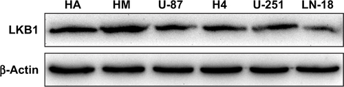 Figure S2 Expression levels of LKB1 in glioma cell lines including U87MG and U251MG and in normal astrocytes.Abbreviation: LKB1, liver kinase B1.