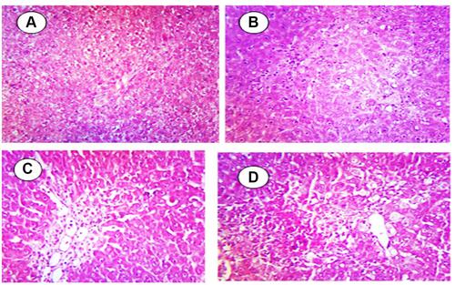 Figure 2 Histopathological liver examination of different doses of citicoline on acetaminophen-induced liver injury in mice. (A) Control group: No changes were observed in this group, (B) APAP-toxin group: Liver tissue changes including tissue necrosis, inflammation of the port ducts and fat alterations were found in this group, (C) Citicoline-treated group one: The improvement effects of inflammation were observed that it is comparable with those in the APAP-toxin group, (D) Citicoline-treated group two: The significant improvement effects of inflammation were observed that it is comparable with those in the APAP-toxin group.