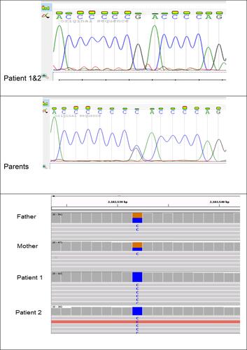 Figure 2 Sanger sequencing and IGV analysis of the family.