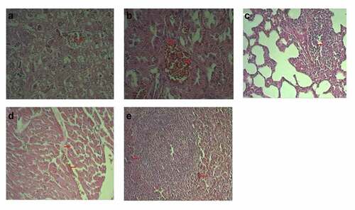 Figure 5. Typical pathological results (HE x 200). №6 Experimental group. (a) Vascular congestion; hepatocyte dystrophy and necrocis microfoci; (b). Kidney vascular congestion; microfoci of tubule epithelium dystrophy (c). Focal proliferation of interalveolar septum cells in lungs; (d). Cardiac edema and hemorrhages; (e). Lymphoid follicle proliferation with hemorrhage microfoci.