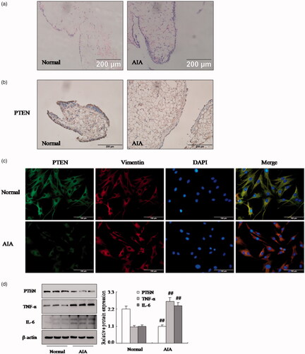 Figure 1. The expression of PTEN was down-regulated in RA FLSs. (a) Representative H&E staining of AIA and normal synovial tissues in rat (original magnification, ×20). (b) The expression of PTEN in AIA and normal synovial tissue was analyzed by IHC staining analysis in rats. (c) The expression of PTEN and Vimentin were analyzed by double immunofluorescence staining analysis in rats AIA and normal FLSs. (d) The protein levels of PTEN, TNF-α and IL-6 were analyzed by Western blotting in AIA and normal FLSs. All values were expressed as mean ± SD. ##p < .01 vs. normal group.