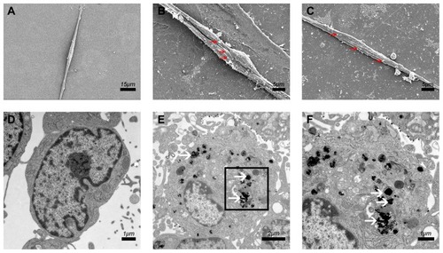 Figure 3 Cellular internalization of PEI-SPIONs.Notes: (A) SEM of SCs in the normal control group; no relevant particles were detected on the surface of the cells. (B, C) At 6 hrs after magnetofection (PEI-SPIONs, 2 μg/mL); red arrows indicate PEI-SPIONs on the surface of cells. (D) No PEI-SPIONs in the cytoplasm of normal control SCs detected through TEM. (E, F) At 24 hrs after magnetofection (PEI-SPIONs, 2 μg/mL); white arrows indicate the internalized PEI-SPIONs in the cytoplasm. (F) Higher magnification of the boxed area in (E). Abbreviations: PEI-SPIONs, polyethylenimine-coated superparamagnetic iron oxide nanoparticles; SCs, Schwann cells; SEM, scanning electron microscopy; TEM, transmission electron microscopy.