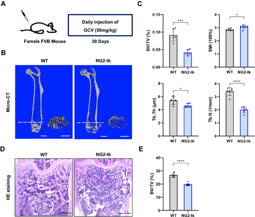 Figure 2 Genetic ablation of pericytes led to reduced bone mass (A) Schematic of NG2-tk mice modeling. Six-week-old female NG2-tk mice were intraperitoneally injected with GCV (50 mg/kg) once a day for 30 consecutive days in order to delete NG2+ pericytes. (B) Representative micro-CT images displaying the three-dimensional architectures of femurs from WT mice and NG2-tk mice (after GCV treatment). Scale bar, 1mm (left panels); 500 μm (right panels). (C) Micro-CT analysis of BV/TV, SMI, Tb.Th, and Tb.N in femurs of WT mice and NG2-tk mice (after GCV treatment, n = 6). (D) Representative H&E staining images of femurs from WT mice and NG2-tk mice (after GCV treatment). Scale bar, 500 μm. (E) Quantification of bone volume fraction (BV/TV) in femurs from WT mice and NG2-tk mice (after GCV treatment, n = 6). Data are presented as mean ± S.E.M. P-values < 0.05 were considered statistically significant, as follows: *P < 0.05; ***P < 0.001; ****P < 0.0001.