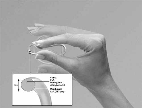 Figure 1 The combined contraceptive vaginal ring (NuvaRing®).