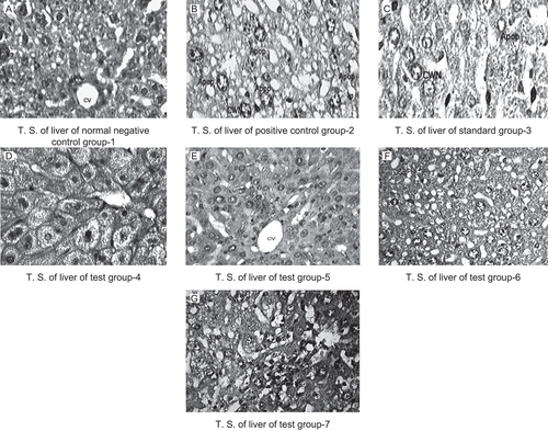 Figure 1.  Histopathological study of rats liver treated with the methanol and petroleum ether extracts of Glycosmis pentaphylla. Photomicrographs of mice liver obtained from different treatment groups. T.S Figure (A) revealed normochromatic hepatocytes (H), occasionally apoptosis, cart wheel nucleus (CWN) and lipid vacuoles (CV). Figure (B) T.S. revealed hyper chromatic highly damaged hepatocytes (H), large numbers lipid vacuoles (LV), frequent apoptosis (Apop), necrosis (CWN). Figure (C) Standard group T.S. revealed normochromatic hepatocytes (H), occasionally apoptosis (Apop), cart wheel nucleus (CWN) and lipid vacuoles (LV). Figure (D) & (E) T.S. revealed normochromatic hepatocytes (H) with good mitotic index, occasionally lipid vacuoles (LV) without apoptosis, necrosis and cart wheel nucleus (S). Figure (F) & (G) T.S. of liver revealed hyper chromatic hepatocytes (H) with average mitotic index, lipid vacuoles (LV) and cart wheel nucleus (CWN), few apoptotic hepatocyts (AH). H and E staining (X400). Group 1(Control), Group 2 (paracetamol 250 mg/kg), Group 3 (paracetamol 250 mg/kg + silymarin 50 mg/kg), Group 4 (paracetamol 250 mg/kg + GPME-200 mg/kg), Group 5 (paracetamol 250 mg/kg + GPME-400 mg/kg), Group 6 (paracetamol 250 mg/kg + GPPE-200 mg/kg) and Group 7 (paracetamol 250 mg/kg + GPPE-400 mg/kg), H & E staining (400X).