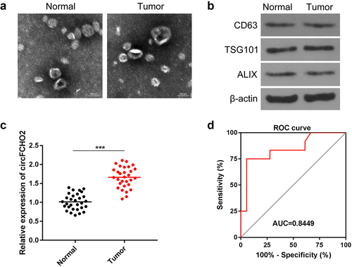 Figure 8. circFCHO2 in serum exosomes was a sensitive and effective biomarker for the diagnosis of GC.